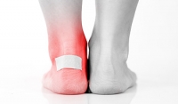 Reasons Blisters May Develop on the Feet