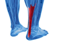 What Causes Achilles Tendon Injuries?