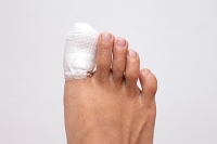 Possible Treatments for a Broken Toe
