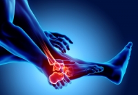 Can You Get Arthritis in Your Feet?