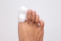 How to Care for a Broken Toe at Home